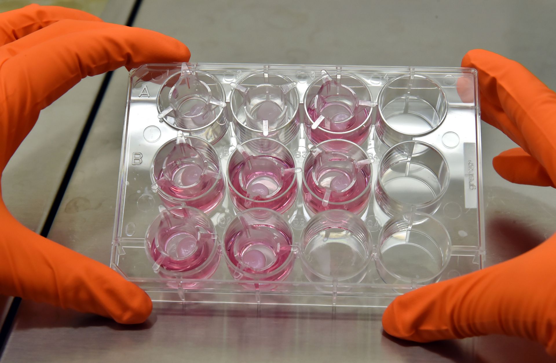 A laboratory engineer controls the quality of a preparation at a biotechnology company in southwestern France in 2016.