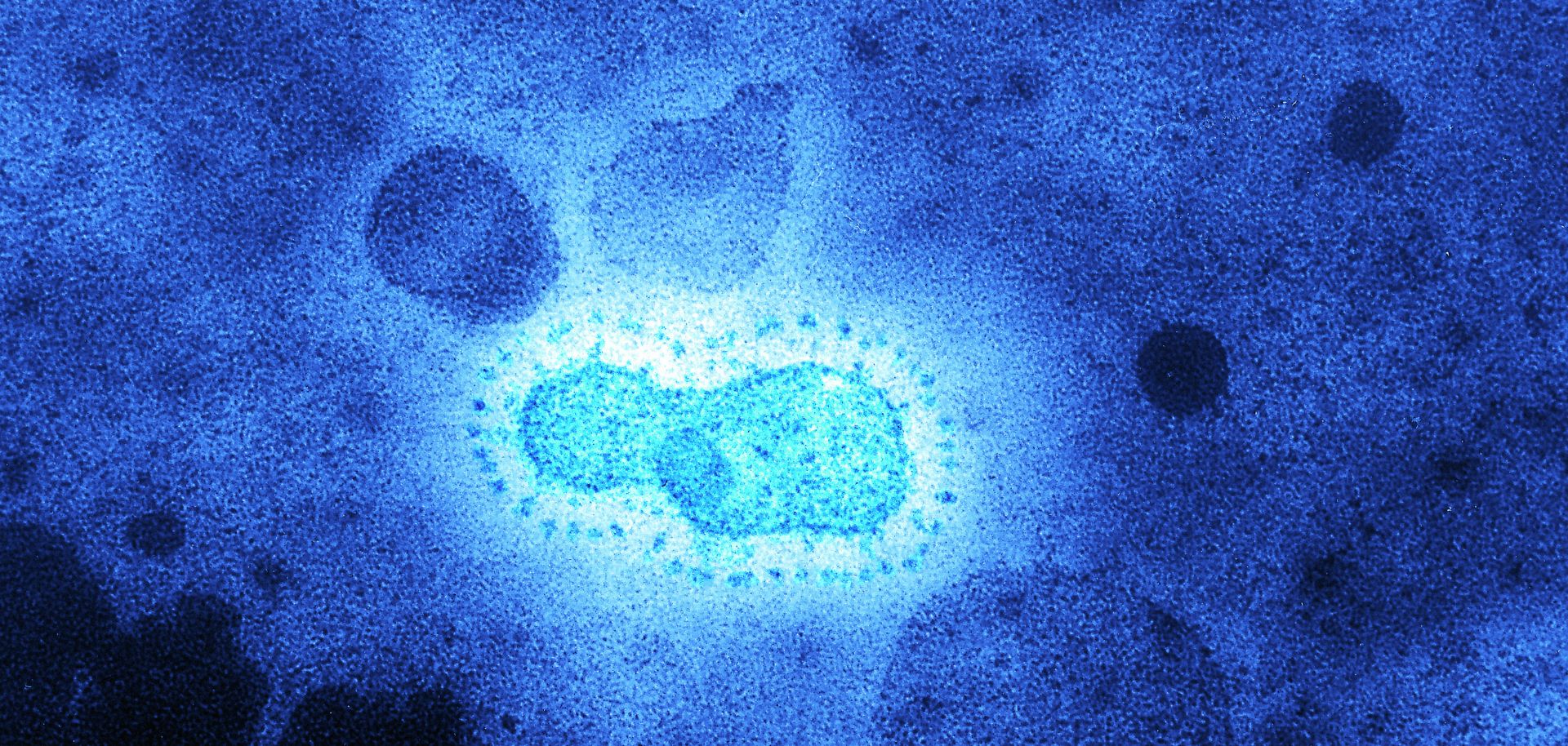 The crown shape of this virus, as shown in a tinted transmission from electron microscopy, gives the coronavirus its name.