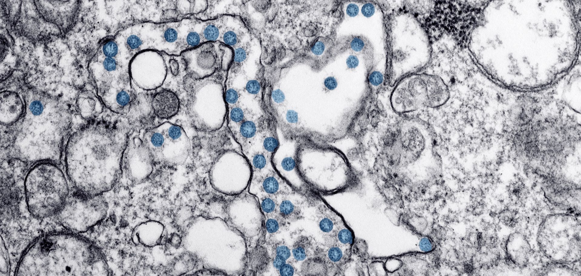 A transmission electron microscopic image of an isolate from a COVID-19 case in March 2020.