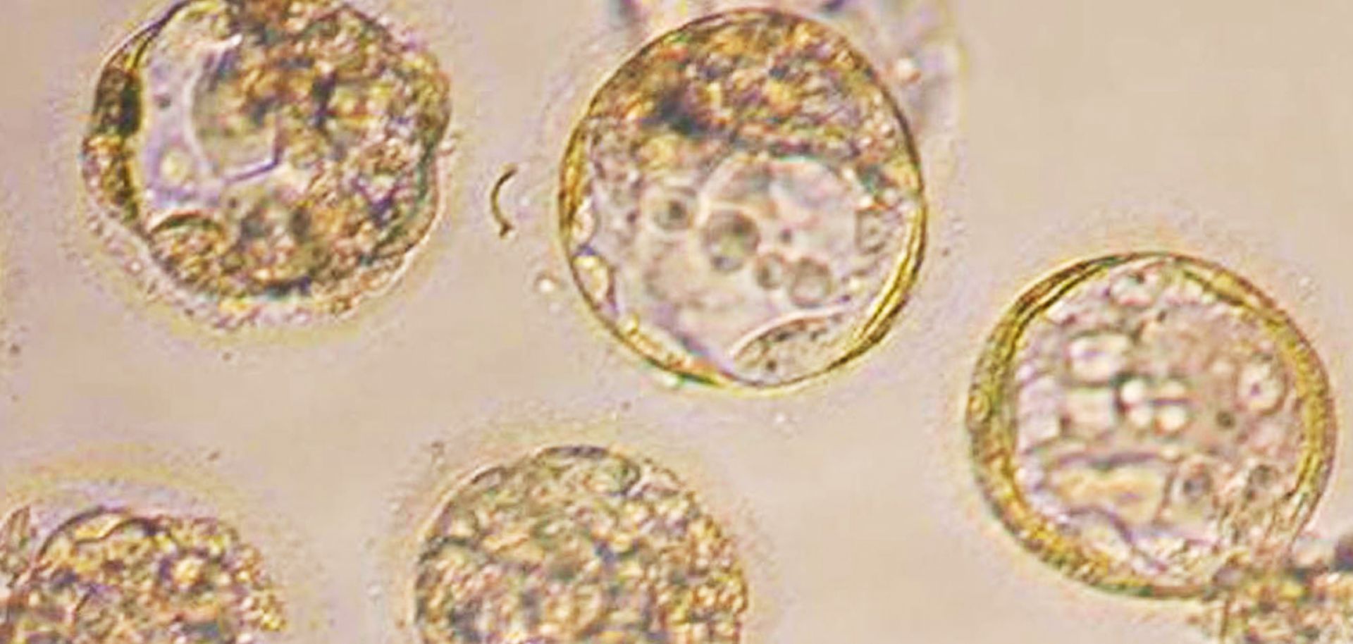 Cloned human embryos are used to generate stem cells in an experiment in Seoul. Humans will be forced to adapt their traditions and morals as technology upsets their lifestyles once again -- this time, by disrupting their methods of reproduction.